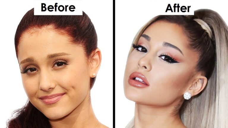 Ariana Grande Plastic Surgery Before and After